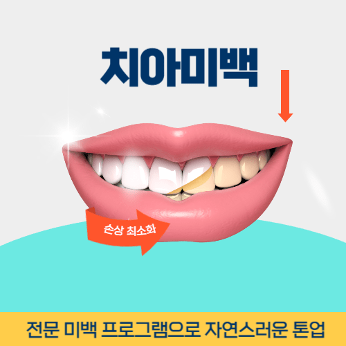 남양주치과 남양주시 치과 치아미백
